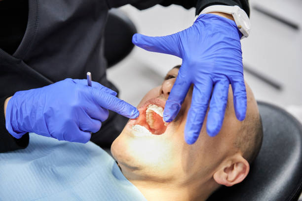 Best Emergency Dental Services for Seniors in Fountainebleau, FL