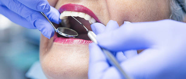 Best Emergency Dentist for Knocked-Out Tooth in Fountainebleau, FL